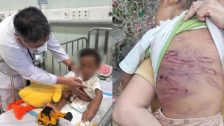Bé trai 2 tuổi trong vụ bạo hành ở TP.HCM qua cơn nguy kịch, hé lộ tình trạng sức khỏe sau điều trị