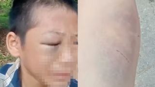 Cơ quan chức năng thông tin vụ bé trai lớp 6 cầu cứu vì bị bố và mẹ kế đánh đập, sợ hãi không dám về nhà