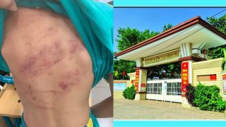 TPHCM: Học sinh lớp 1 bị bạn đánh hội đồng chỉ vì cái bánh, bất ngờ cách giải quyết của trường