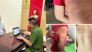 Diễn biến nóng vụ mẹ đau đớn công khai tình trạng ‘đầy ám ảnh’ của con trai nghi bị bố ruột bạo hành