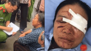 Trách nhiệm pháp lý vụ người phụ nữ bán rau bị xịt nước áp lực cao dẫn đến chảy máu mắt gây bức xúc