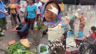 Tình trạng mắt của người phụ nữ bán rau bị chủ quán hải sản xịt nước tăng áp vào mặt, gia đình lên tiếng đòi công bằng 