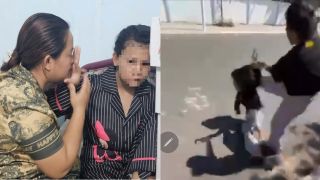 Nữ sinh bị đánh hội đồng, lột quần quay clip: Hiện không nhìn thấy đường, nhóm ra tay không bị xử phạt