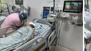 Tình hình bé trai 11 tuổi ở TP HCM bị bạn học dùng kéo đâm xuyên hộp sọ