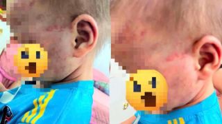 Cha dượng khai gì sau vụ bé trai 3 tuổi ở Gia Lai bị bạo hành phải nhập viện?