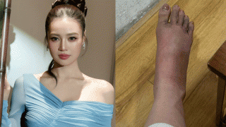 Netizen lo sốt vó khi Ninh Dương Lan Ngọc bất ngờ hé lộ thông tin từng giấu kín về sức khỏe