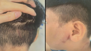 Bé trai 8 tuổi bị cha ruột đánh đến nhập viện: Bà ngoại kể lại cảnh tượng sau cuộc gọi cầu cứu