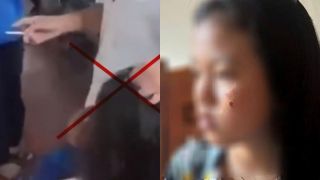 Vụ nữ sinh ở Đắk Lắk bị đánh, dí thuốc lá vào mặt: Gia đình tiết lộ tình trạng mới nhất