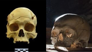 Hộp sọ 2.700 năm tuổi hé lộ điều gây sốc về y học thời cổ đại, thế giới chấn động không dám tin