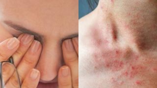 Ngứa 2 bộ phận này trên cơ thể, đừng nhầm là dị ứng, có thể là tín hiệu của ung thư gan