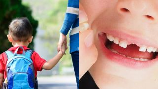 Bị bạn cùng lớp né tránh, nam học sinh tiểu học đẩy bạn ngã gãy răng khiến phụ huynh bức xúc