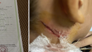 Cháu bé 11 tuổi bị hành hạ khi đi câu cá nhà hàng xóm, cơ quan chức năng vào cuộc điều tra