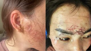 Chấn động vụ bắt cóc đánh ghen, tạt axit và xăm lên mặt ‘tình địch’ ở Cà Mau, công an vào cuộc