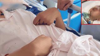 Xót xa vụ việc người mẹ bị đánh đến teo não, mặt biến dạng khi cố bảo vệ con gái 13 tuổi khỏi kẻ trộm