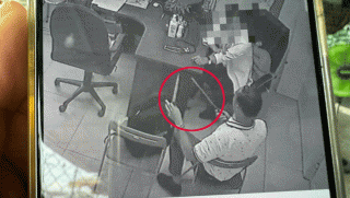 Bác sĩ Khoa Nhi bất ngờ bị đồng nghiệp cầm 2 dao tấn công, phải nhập viện điều trị vùng đầu và vai