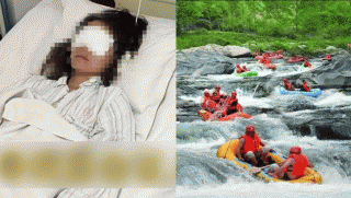 Cô gái bị bắn mù mắt khi đang ngồi trên thuyền ở một điểm tham quan khẩn cầu tìm nhân chứng