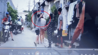 Nam thanh niên ở TP.HCM bị đánh nhập viện khi nhắc nhở xe hút hầm cầu chắn gần như toàn bộ lối đi