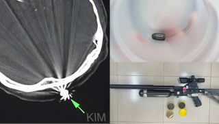 Lời khai của người bắn súng khiến người phụ nữ làm vườn trúng đạn, hé lộ mục đích vác súng ra đường