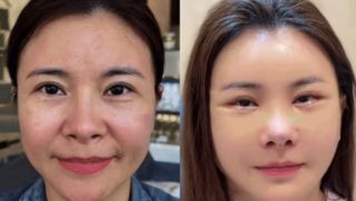 Diễn viên Kim Oanh gây tranh cãi với diện mạo mới sau ca ‘dao kéo’ toàn mặt: Chính chủ lên tiếng đáp trả