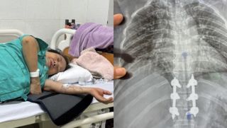 Tìm tài xế xe máy đâm bà lão ở Buôn Ma Thuột rồi bỏ trốn: Nạn nhân gãy 3 đốt sống, chưa có tiền phẫu thuật