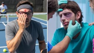Chấn thương mắt khi chơi pickleball tăng mạnh, chuyên gia cảnh báo cảnh báo nguy cơ tiềm ẩn