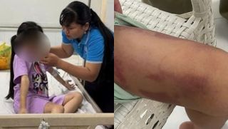 Tạm giữ mẹ ruột 25 tuổi và bạn trai 19 tuổi đánh đập cháu bé ở TP.HCM đến mức phải nhập viện