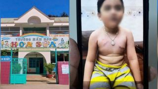 Vụ phụ huynh tố cô giáo 'nhéo trẻ bầm ngực': Cách giải quyết của nhà trường gây bất ngờ