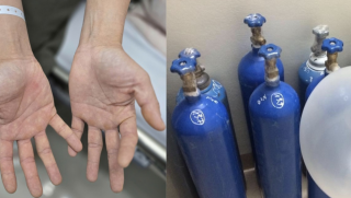 ‘Chỉ chơi cho vui’ – Hai vợ chồng trẻ liệt tứ chi vì nghiện bóng cười