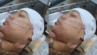 Lời khai của nữ cán bộ phường cầm dao rạch mặt tình địch vì ghen tuông ở Đồng Tháp, gia đình có động thái lạ