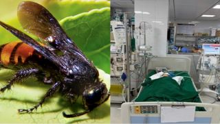 Bé gái bị ong vò vẽ đốt hơn 50 nốt, nhập viện trong nguy kịch, sau nửa tháng xuất hiện điều kỳ diệu