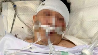 TPHCM: Tông trúng chó chạy rông, nam thanh niên nhập viện trong tình trạng 'ngàn cân treo sợi tóc'