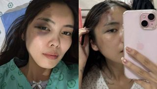 Người vợ bị chồng đánh chấn động não hé lộ tình tiết phẫn nộ, vợ cũ ra mặt vạch trần bản chất người đàn ông