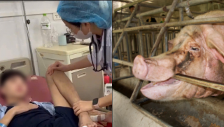 Tình hình sức khỏe của nam thiếu niên bị lợn cắn tại Sơn La sau 1 tháng điều trị 