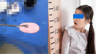 TP.HCM: Bé gái 12 tuổi cấp cứu vì nhét cục xà bông vào ‘nơi riêng tư’, bác sĩ cảnh báo khẩn