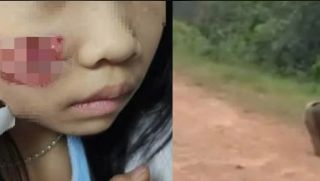 Con khỉ hoang ở Quảng Bình tấn công 5 người: Cháu bé 7 tuổi phải nhập viện với nhiều vết thương