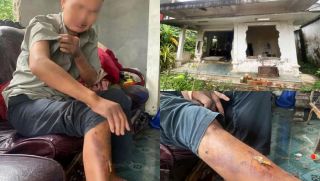 Vụ người đàn ông bị nhóm học sinh lột đồ, hành hung hơn 10 lần ở Huế: Hé lộ gia cảnh bất hảo