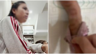 Phẫn nộ lý do không thể chấp nhận của cô giáo mầm non nghi tương tác trẻ tím tái tay chân không thể đi lại