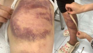 Vụ người đàn ông trói con gái, đánh đập vợ bầu ở Bắc Ninh: Đối tượng bị xử lý những tội gì?