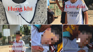 Gia đình xót xa khi con học lớp 6 bị bạn đánh phải cấp cứu: Nguyên nhân xô xát? Tình trạng hiện tại?