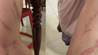 Vụ con gái 9 tuổi nghi bị mẹ ruột tác động vật lý 34 vết bầm: Người bố tiết lộ loạt tình tiết gây bất ngờ