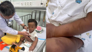 Hoàn cảnh éo le, không nơi nương tựa của bé trai 2 tuổi bị mẹ ruột và người tình bạo hành ở TP.HCM