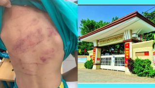TPHCM: Học sinh lớp 1 bị bạn đánh hội đồng chỉ vì cái bánh, bất ngờ cách giải quyết của trường