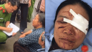 Trách nhiệm pháp lý vụ người phụ nữ bán rau bị xịt nước áp lực cao dẫn đến chảy máu mắt gây bức xúc