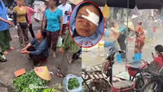 Tình trạng mắt của người phụ nữ bán rau bị chủ quán hải sản xịt nước tăng áp vào mặt, gia đình lên tiếng đòi công bằng 