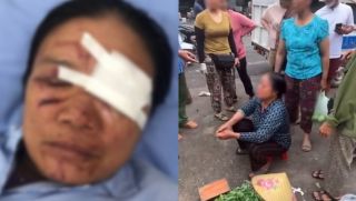 Camera ghi lại nguồn cơn vụ người phụ nữ bán rau bị xịt nước đến chảy máu mặt, tình hình đáng lo của nạn nhân