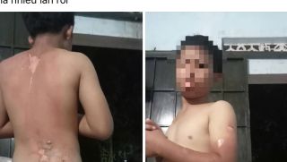 Công an thông tin vụ mẹ tạt nước sôi lên người khiến con trai bị bỏng ở Đắk Lắk 