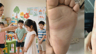 Cô giáo bị tố đánh bé 3 tuổi đau nhiều ngày, phải đi tập tễnh: Cô giáo đã thừa nhận, gia đình thông tin nóng