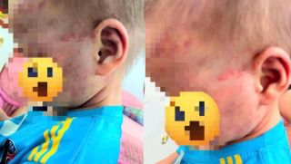 Cha dượng khai gì sau vụ bé trai 3 tuổi ở Gia Lai bị bạo hành phải nhập viện?