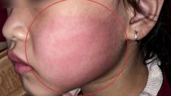 Bé gái 4 tuổi đứng nhảy trước nhà bất ngờ bị người lạ tát mạnh, camera tiết lộ tình tiết bất ngờ