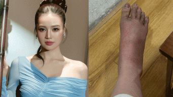 Netizen lo sốt vó khi Ninh Dương Lan Ngọc bất ngờ hé lộ thông tin từng giấu kín về sức khỏe